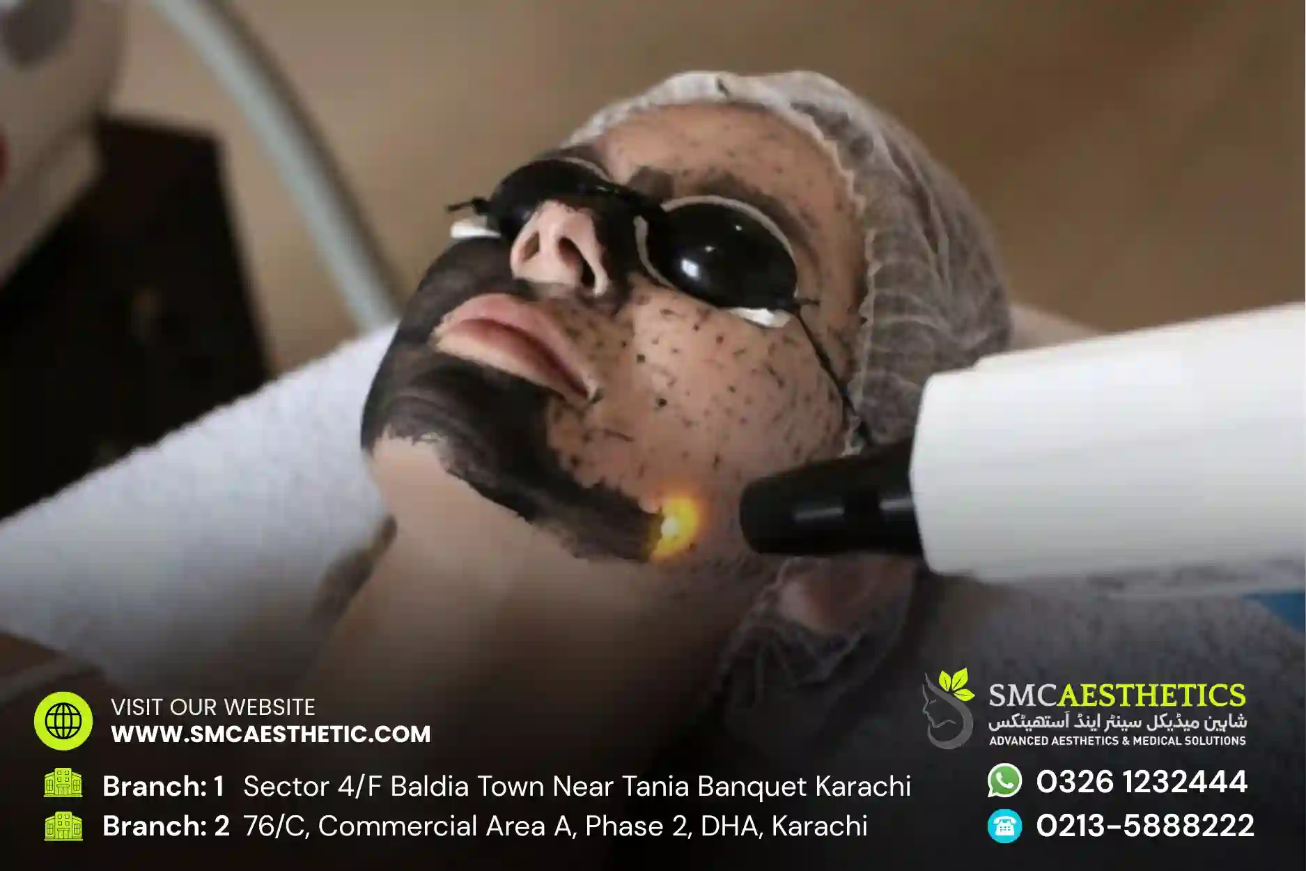 Carbon Facial