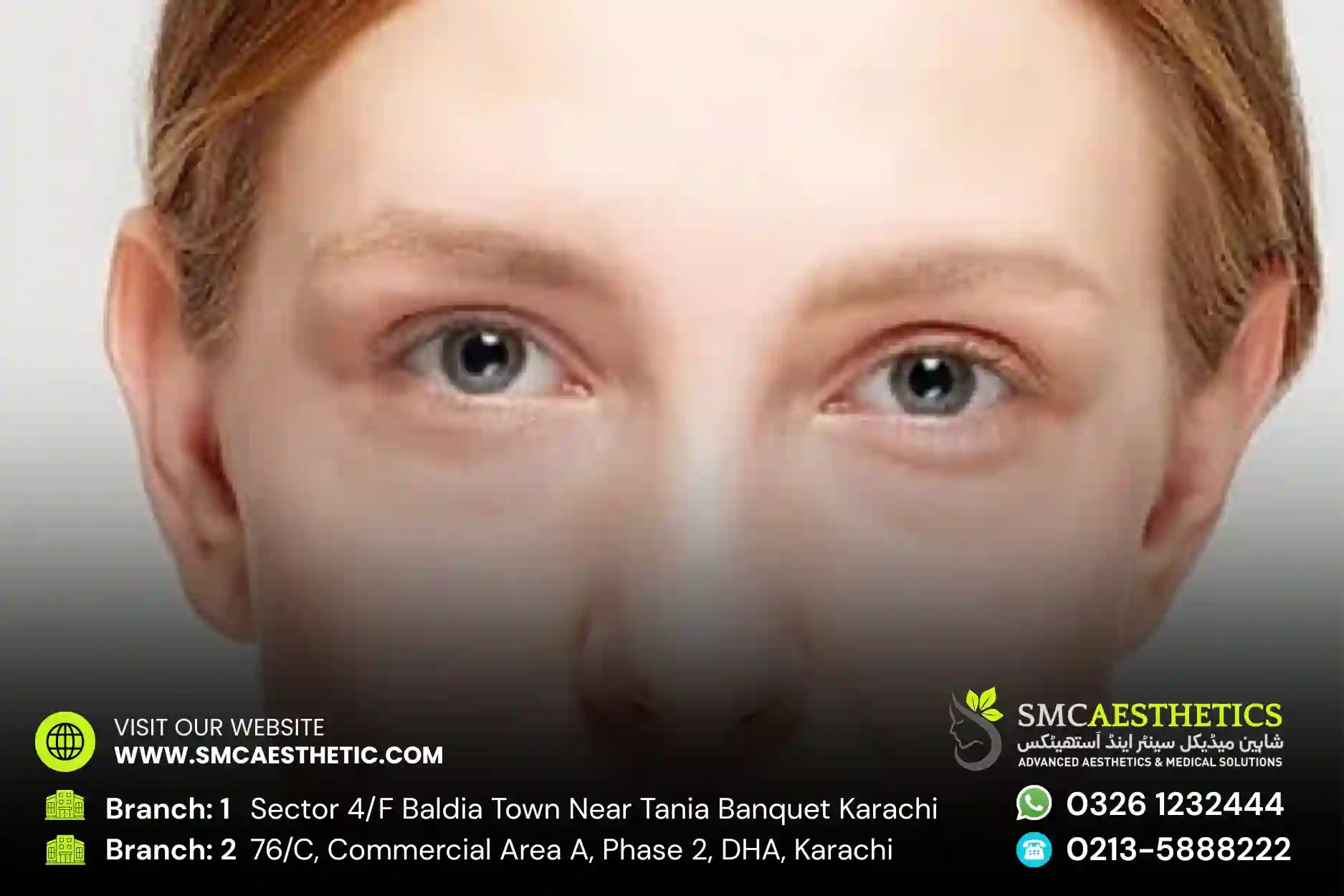 Puffy Eyes Treatment